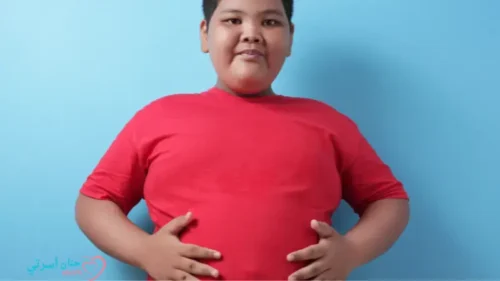 اكتشف أسباب سمنة وكيفية مواجهتها