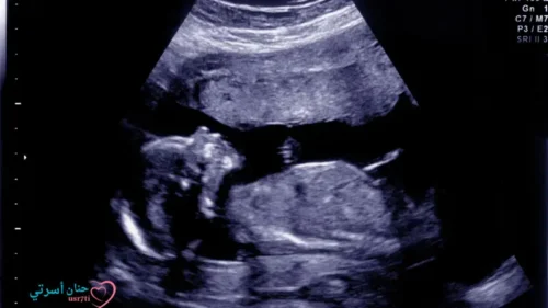 اكتشف أطعمة تزيد وزن الجنين 