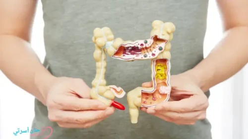 حل مشكلة الإمسك